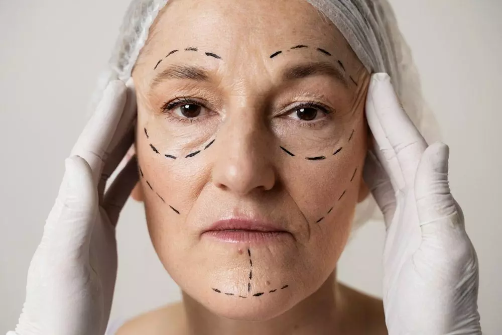 Facelifts in Abu Dhabi
