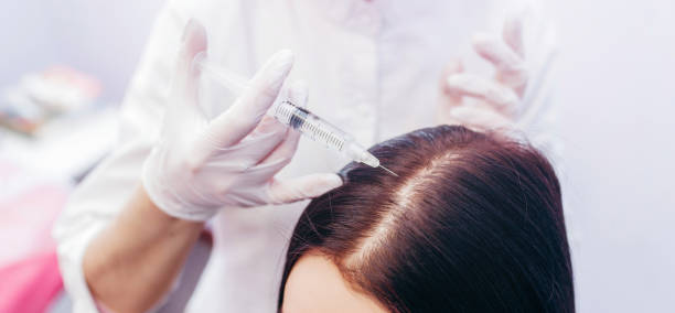 How Can Best PRP Hair Treatment Restore Hair Confidence