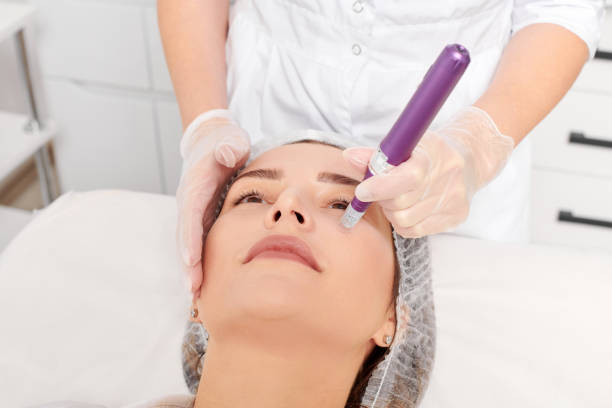 How Long Do microneedling Results Usually Last on Skin