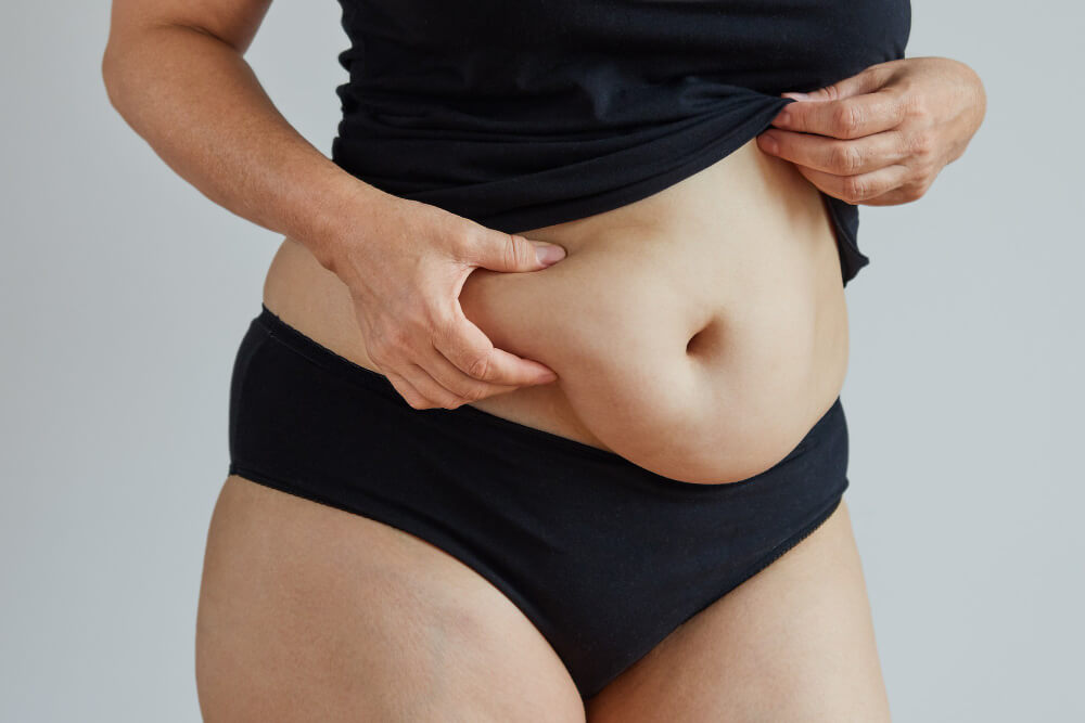 Mini Abdominoplasty in Abu Dhabi