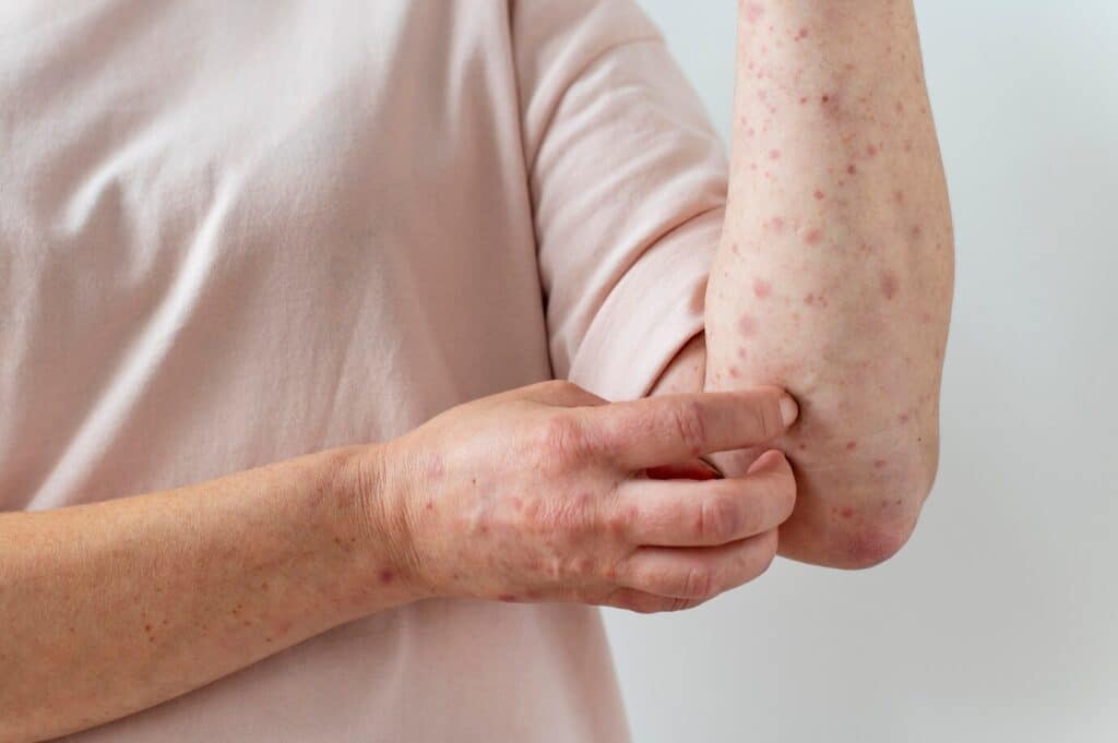 Skin Diseases Treatment in Abu Dhabi