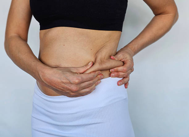 Is Fat Reduction the Best Option for Targeted Fat Loss