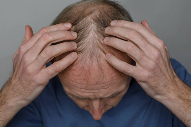 Is GFC Treatment for Hair Safe for Long-Term Hair Care