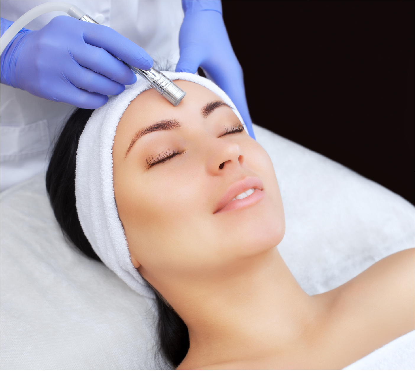 Microneedling for Acne Scars in Abu Dhabi