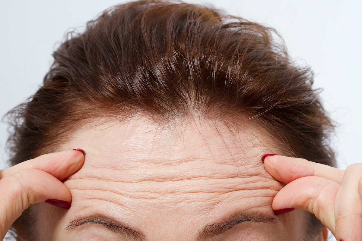 Fine Lines and Wrinkle Removal in Abu Dhabi