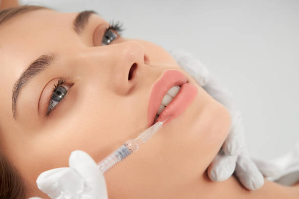 What Are the Benefits of Russian Lip Fillers