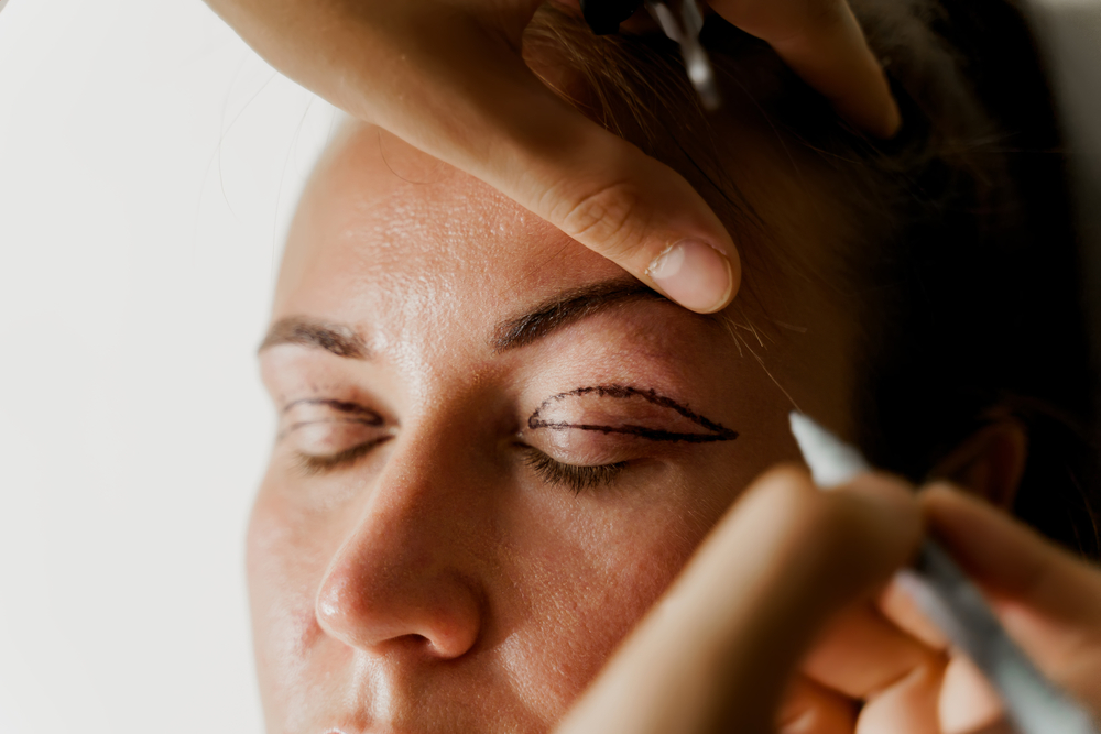 Eyelid Surgery in Abu Dhabi