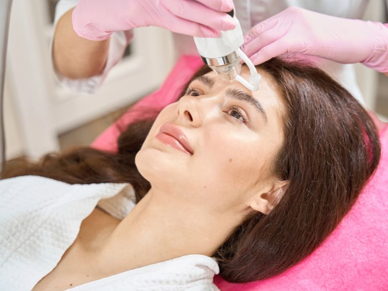 Fractional RF Micro Needling in Abu Dhabi