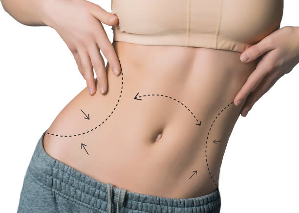 Can Liposuction Enhance Natural Body Curves
