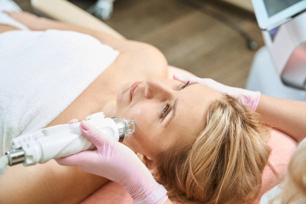 Can Microneedling for Acne Scars Provide Natural Smooth Skin Results