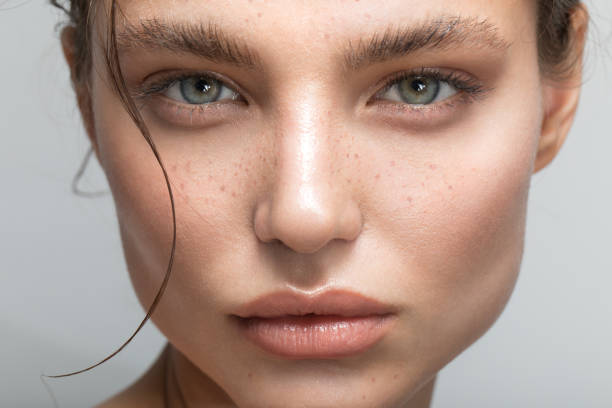Does Dark Circles Treatment Require Any Downtime