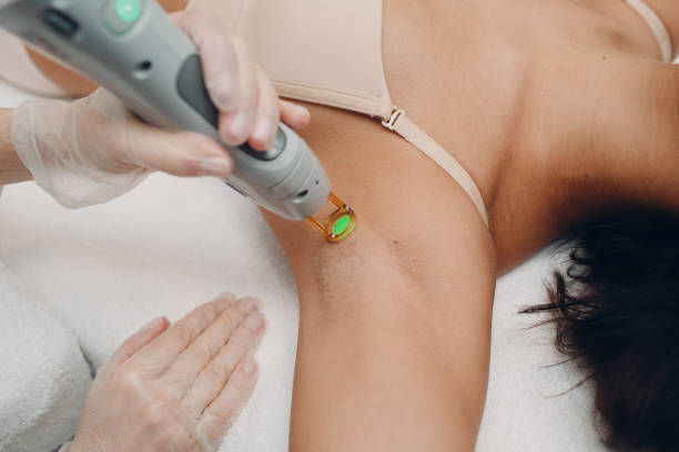 Does Laser Hair Removal Help With Sensitive Skin Issues