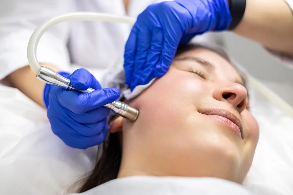 Microdermabrasion treatment in Abu Dhabi