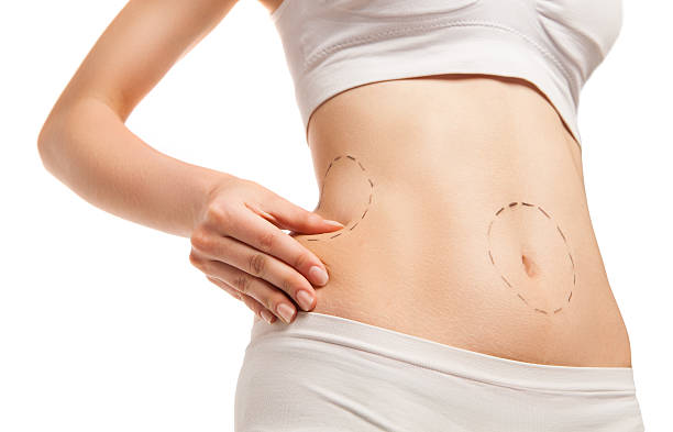 Does Mini Tummy Tuck Help Improve the Overall Body Contour