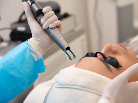 Pico Laser Treatment Abu Dhabi