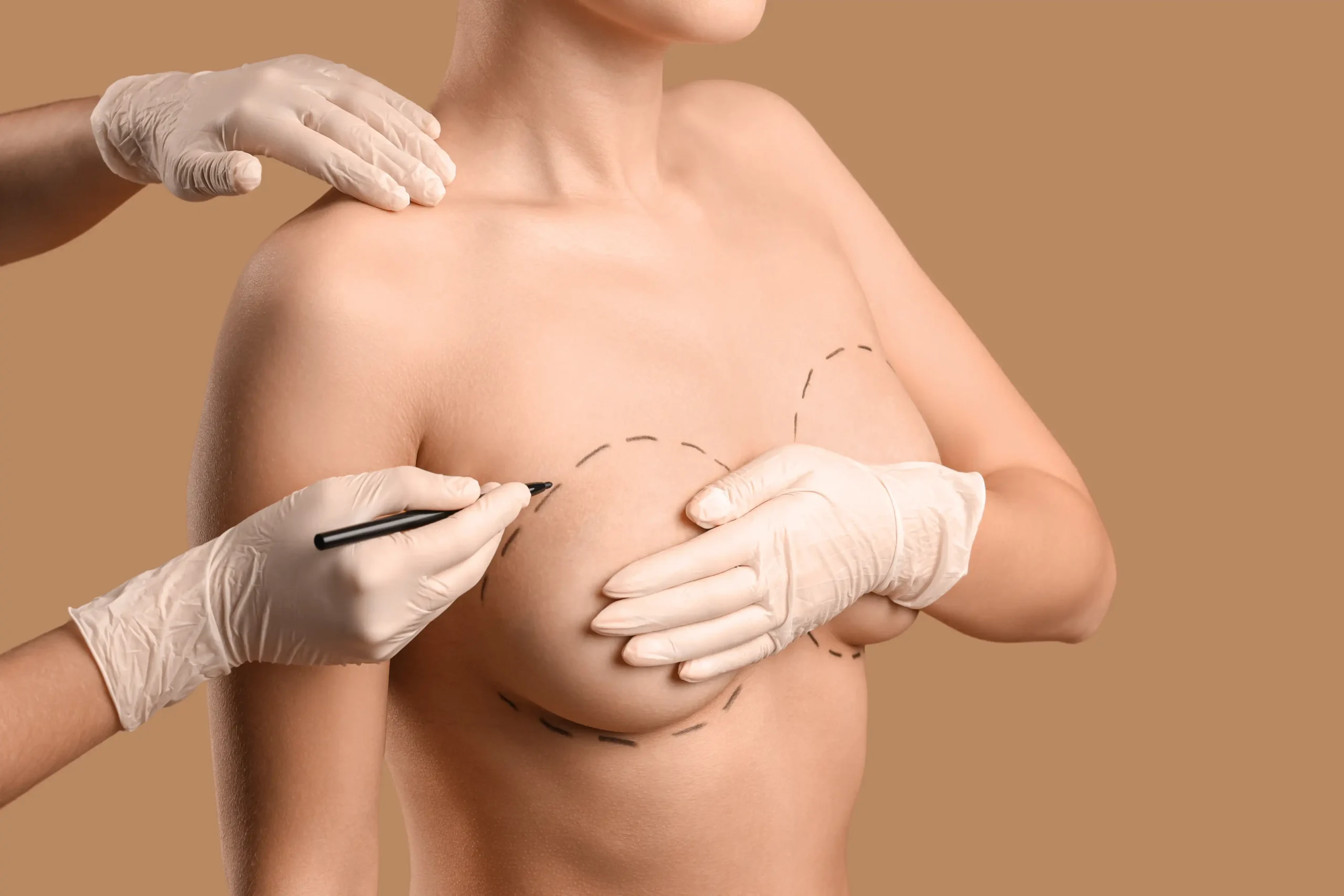 Breast Lift Surgery in Abu Dhabi