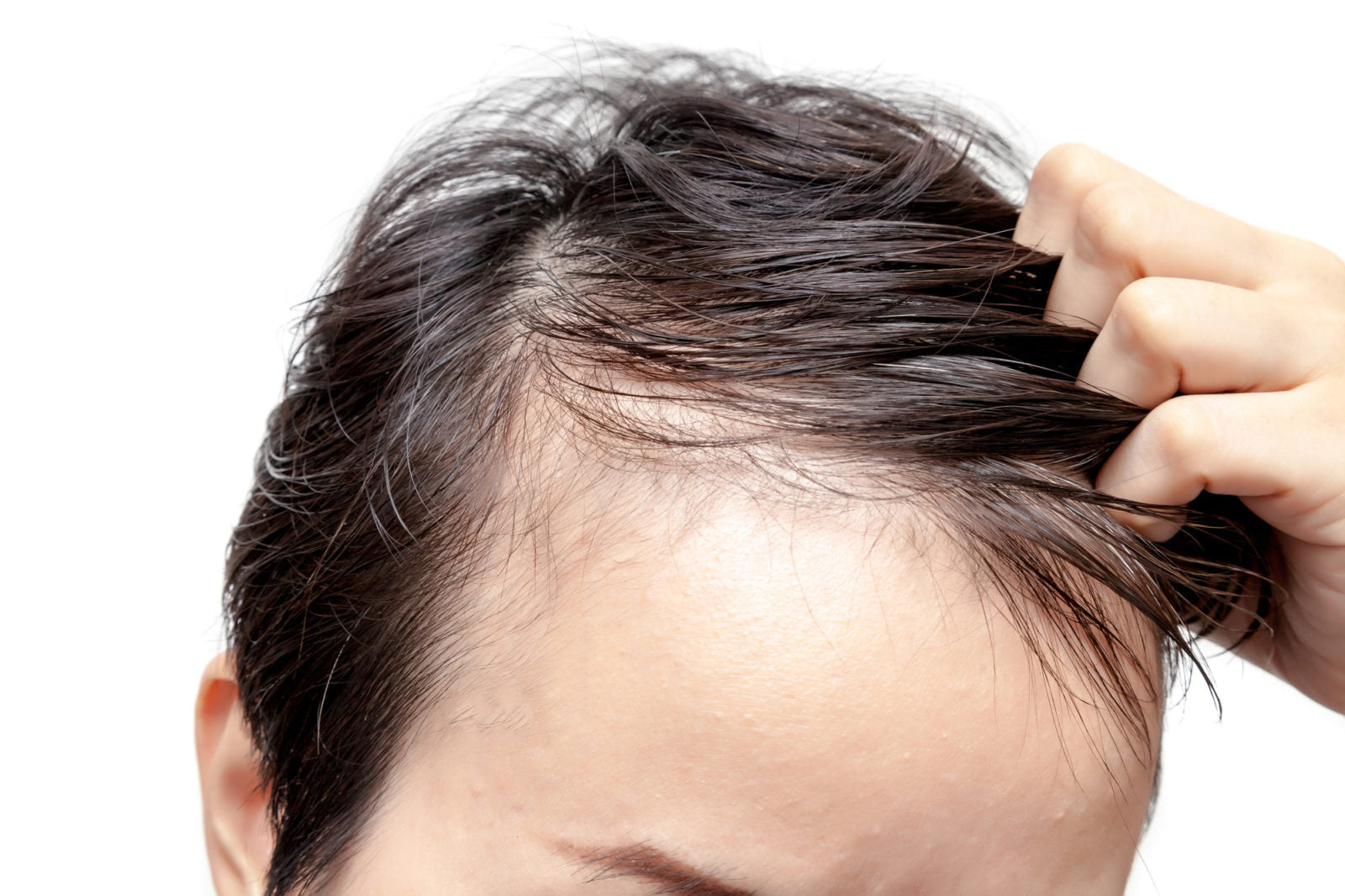 Scalp Micropigmentation Abu Dhabi