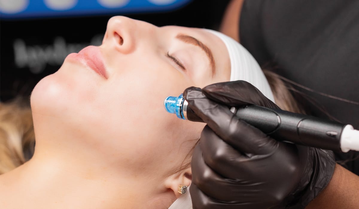 Fractional RF Micro Needling Abu Dhabi