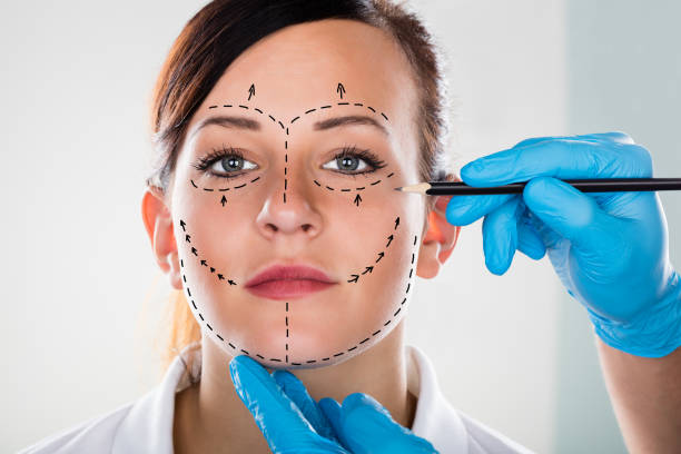 Is a Facelift the Right Choice for Facial Rejuvenation Goals