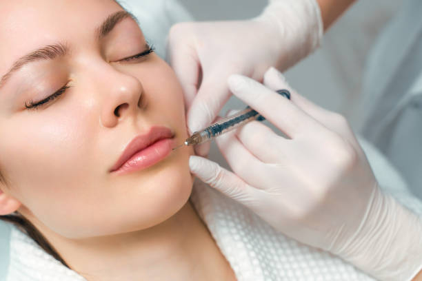 What Makes Lip Fillers Injection So Popular Today